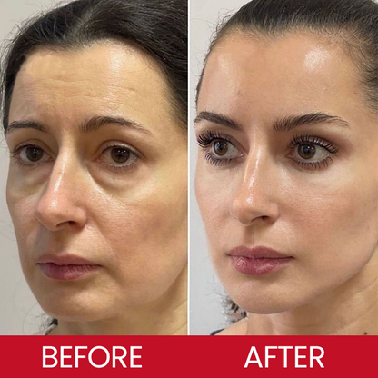 LIMETOW® Retinol Eye Stick✅ for Reduces Fine Lines，Puffiness and Dark Circles🌟