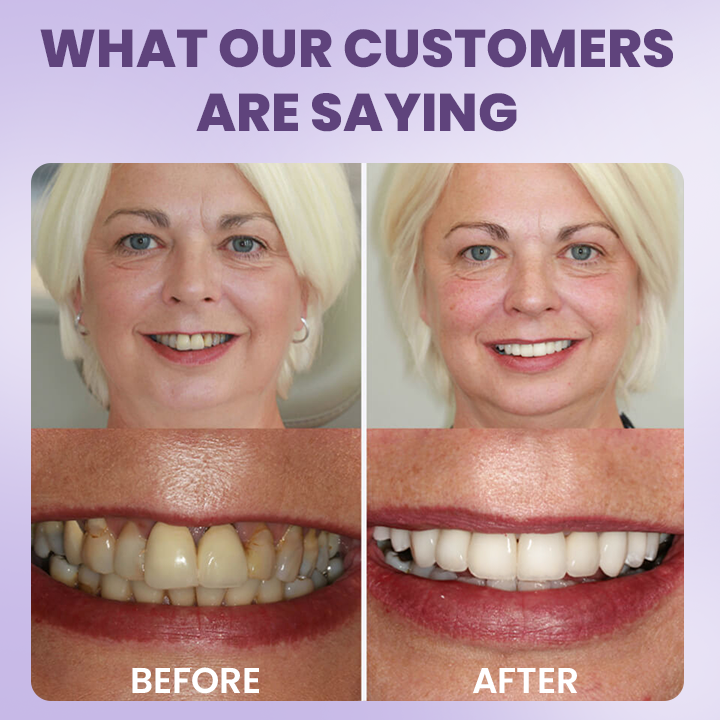 LIMETOW® Instant Teeth Whitening Stick