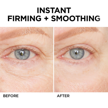 LIMETOW® Instant Eye Cream Tightener✨