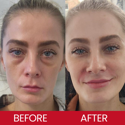 LIMETOW® Retinol Eye Stick✅ for Reduces Fine Lines，Puffiness and Dark Circles🌟