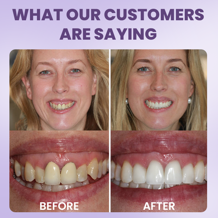 LIMETOW® Instant Teeth Whitening Stick