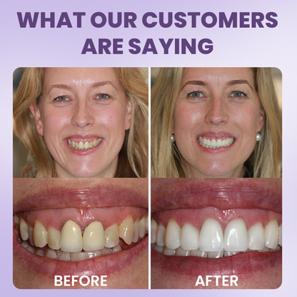 LIMETOW® Instant Teeth Whitening Stick