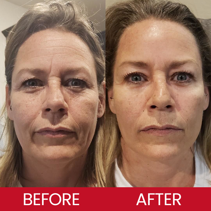 LIMETOW® Retinol Eye Stick✅ for Reduces Fine Lines，Puffiness and Dark Circles🌟