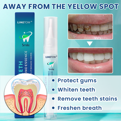LIMETOW®  Teeth Brightening Essence
