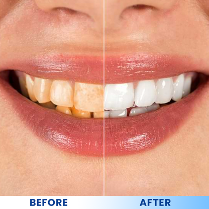 LIMETOW®  Teeth Brightening Essence