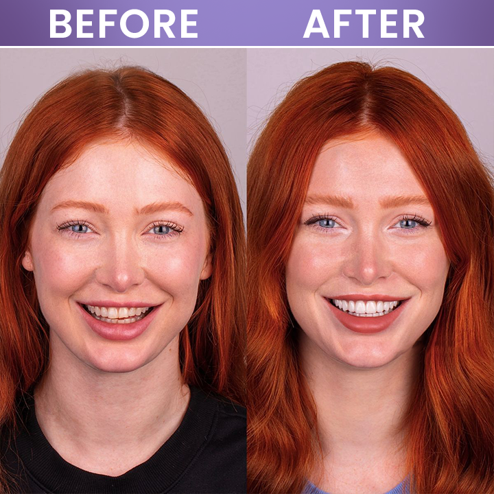 LIMETOW® Instant Teeth Whitening Stick