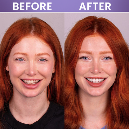LIMETOW® Instant Teeth Whitening Stick