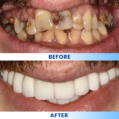 LIMETOW®  Teeth Brightening Essence