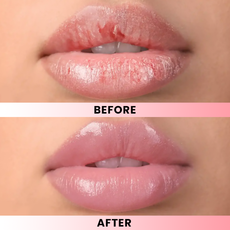 LIMETOW® Lip Softening Serum