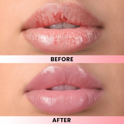 LIMETOW® Lip Softening Serum