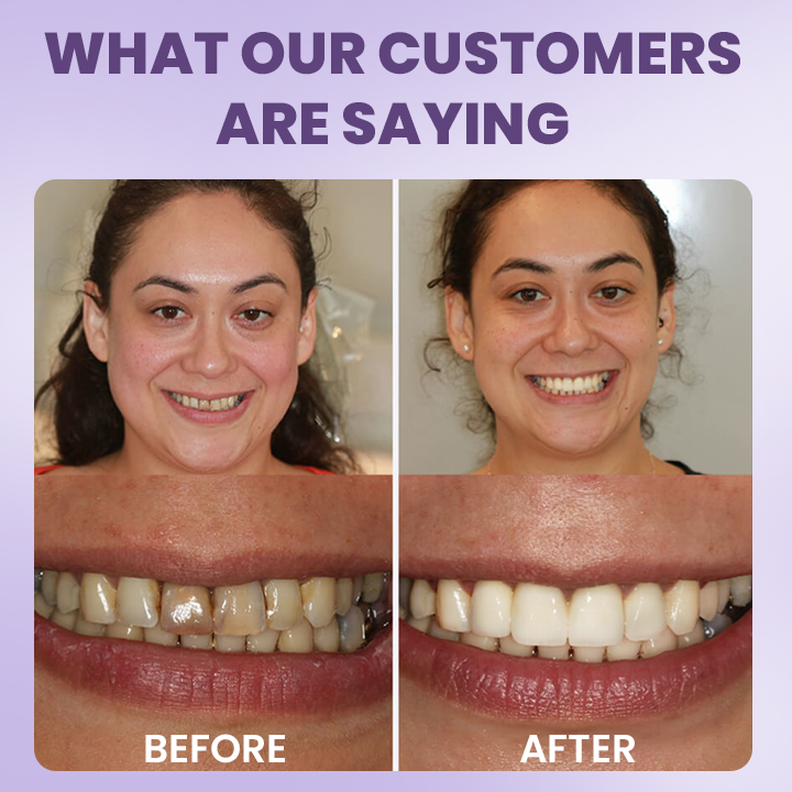 LIMETOW® Instant Teeth Whitening Stick