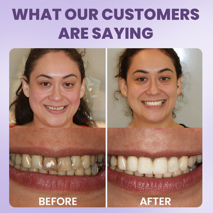 LIMETOW® Instant Teeth Whitening Stick
