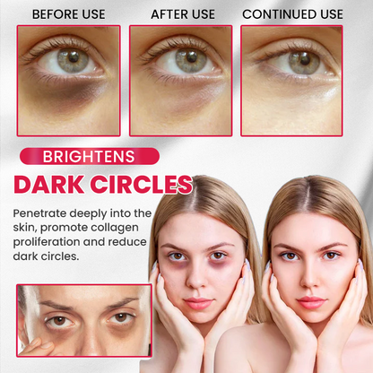 LIMETOW® Retinol Eye Stick✅ for Reduces Fine Lines，Puffiness and Dark Circles🌟