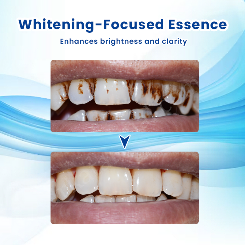 LIMETOW®  Teeth Brightening Essence