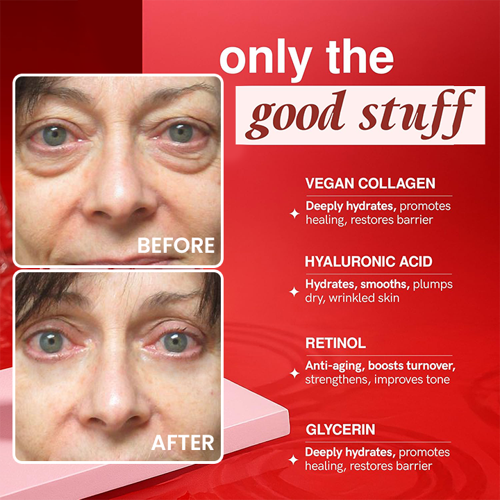 LIMETOW® Retinol Eye Stick✅ for Reduces Fine Lines，Puffiness and Dark Circles🌟
