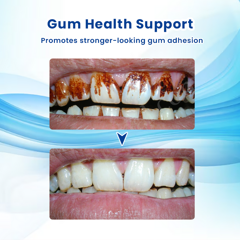 LIMETOW®  Teeth Brightening Essence