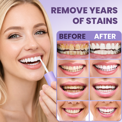 LIMETOW® Instant Teeth Whitening Stick