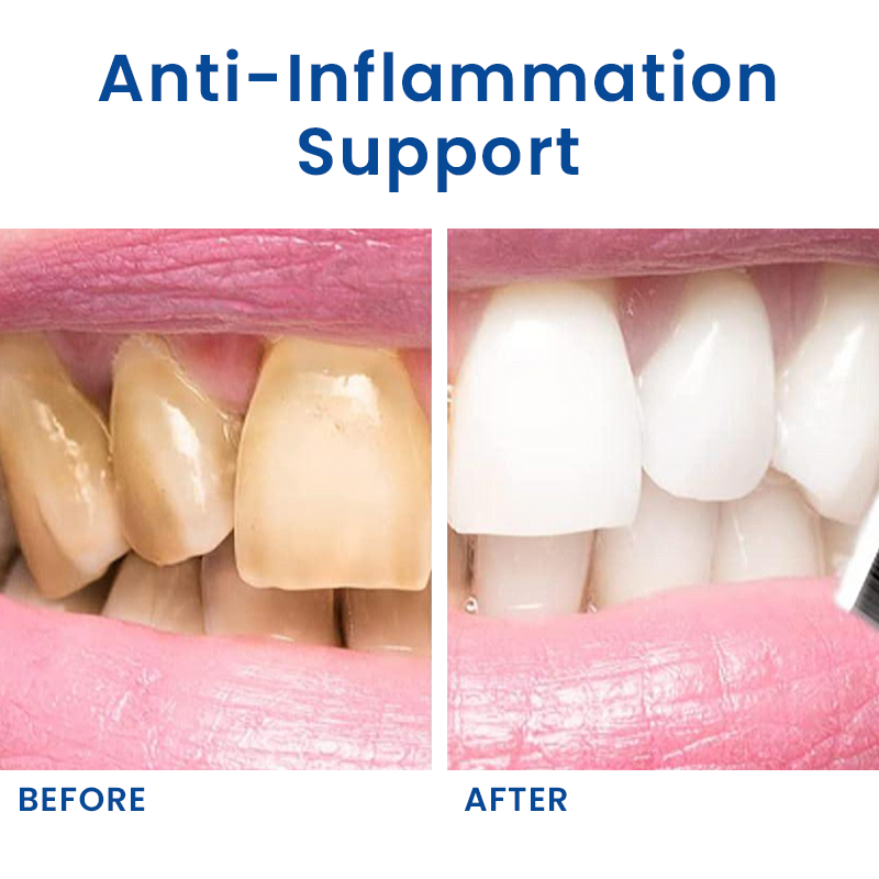 LIMETOW®  Teeth Brightening Essence