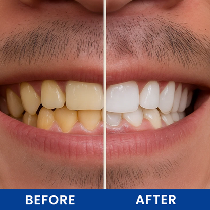 LIMETOW®  Teeth Brightening Essence