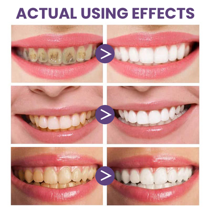 LIMETOW® Instant Teeth Whitening Stick