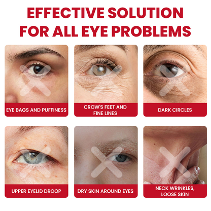 LIMETOW® Retinol Eye Stick✅ for Reduces Fine Lines，Puffiness and Dark Circles🌟