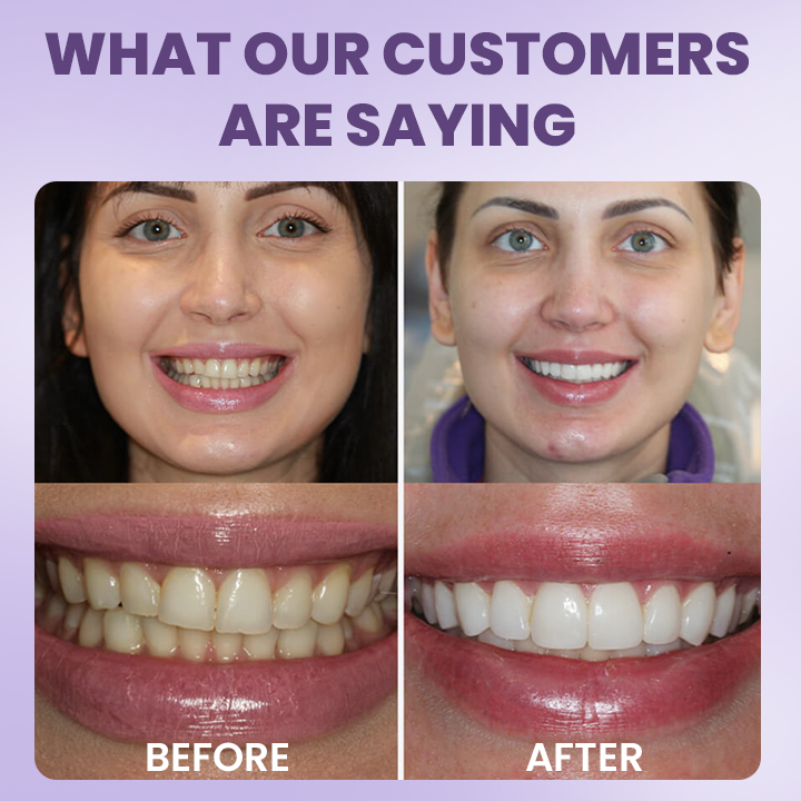 LIMETOW® Instant Teeth Whitening Stick