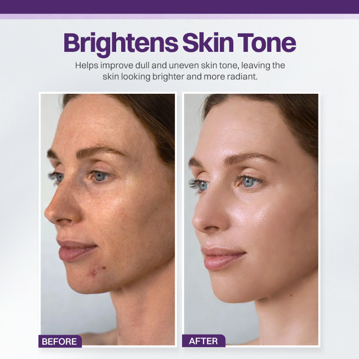 LIMETOW® Spot Refiner