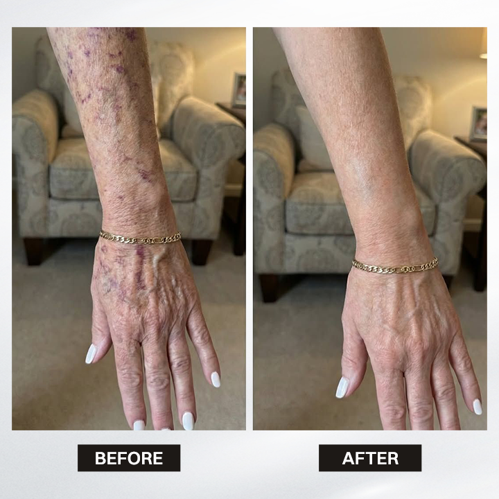 LIMETOW® Silk Body Oil