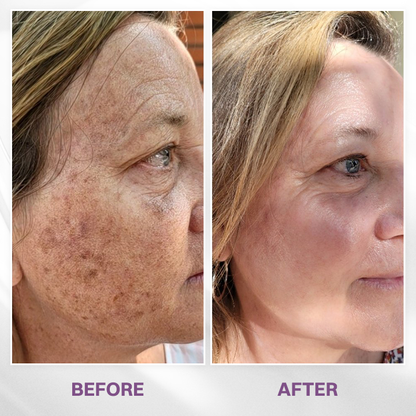 LIMETOW® Spot Refiner