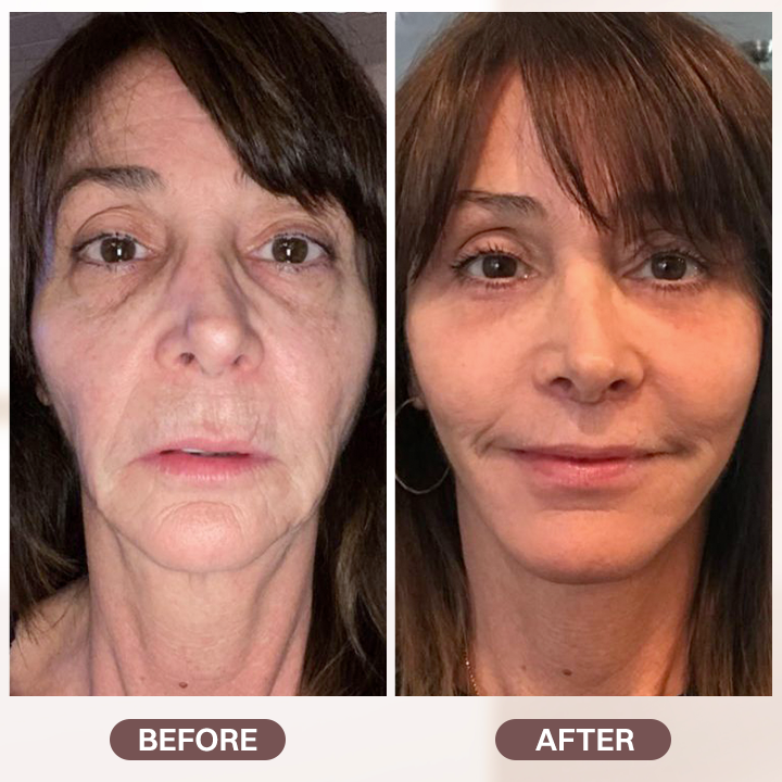 LIMETOW® Retinol Cream