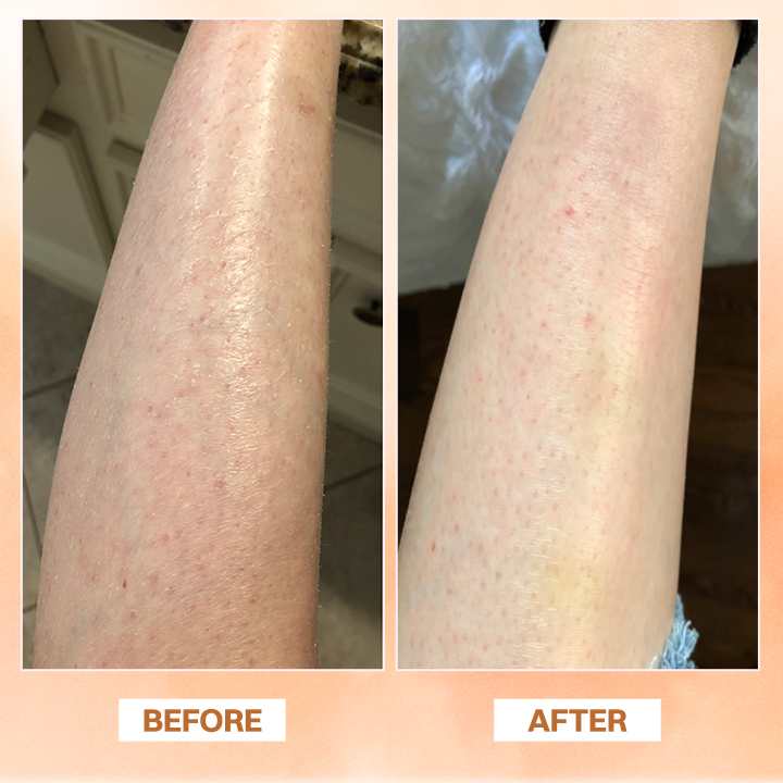 LIMETOW® Essential Oil Balm