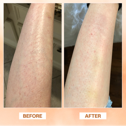 LIMETOW® Essential Oil Balm