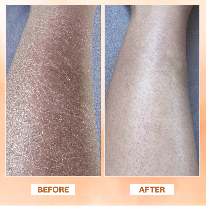 LIMETOW® Essential Oil Balm