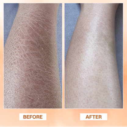 LIMETOW® Essential Oil Balm