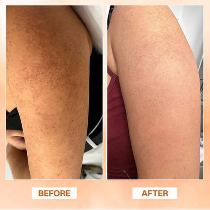 LIMETOW® Essential Oil Balm