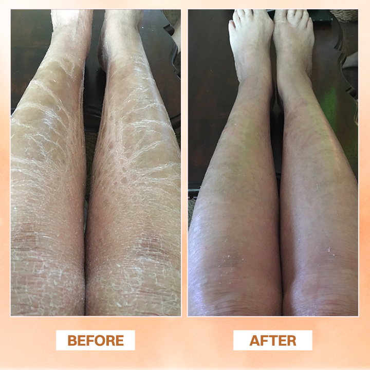 LIMETOW® Essential Oil Balm