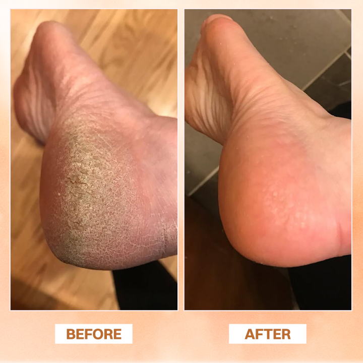 LIMETOW® Essential Oil Balm