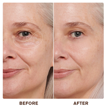 LIMETOW® Instant Eye Cream Tightener✨