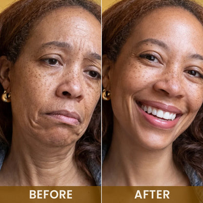 LIMETOW® 24K Gold Anti-Wrinkle Mask