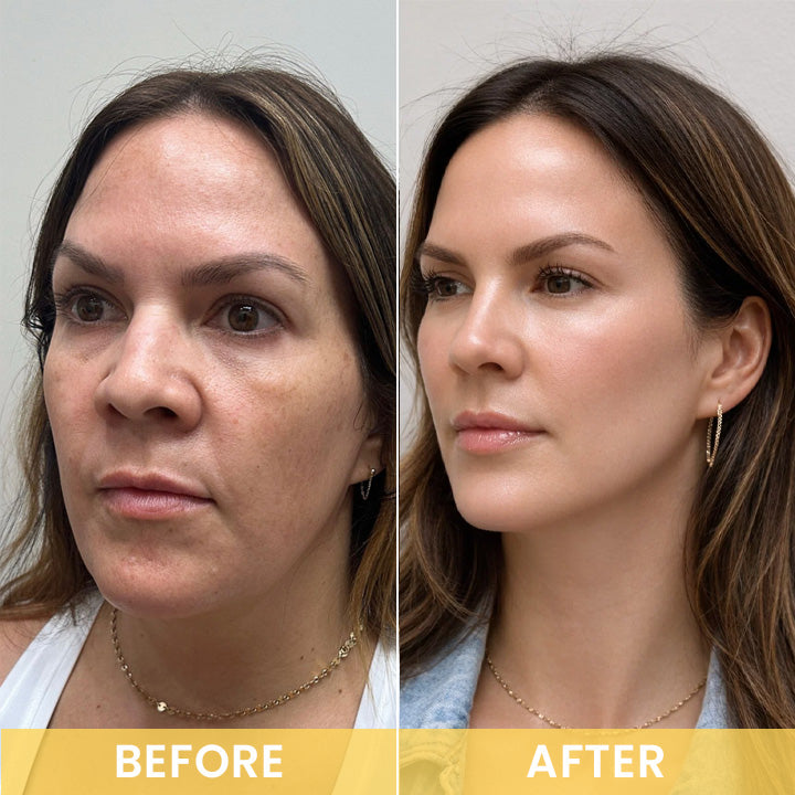 LIMETOW® Deep Collagen Silk Peptide Intensive Ampoule