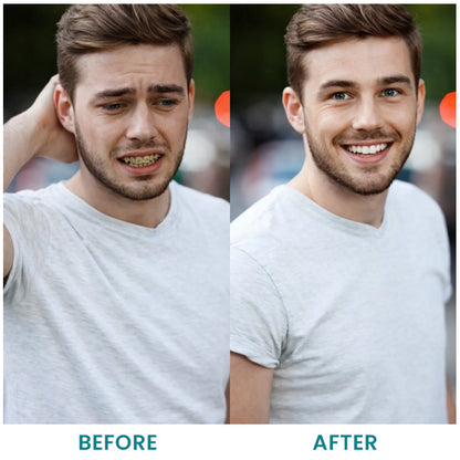 LIMETOW® Instant Teeth Whitening Paint