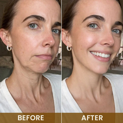 LIMETOW® 24K Gold Anti-Wrinkle Mask