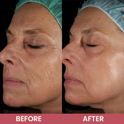 LIMETOW® Compact Anti-Wrinkle Bar