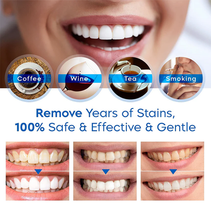 LIMETOW™ 🔥Teeth Whitening Essence🔥