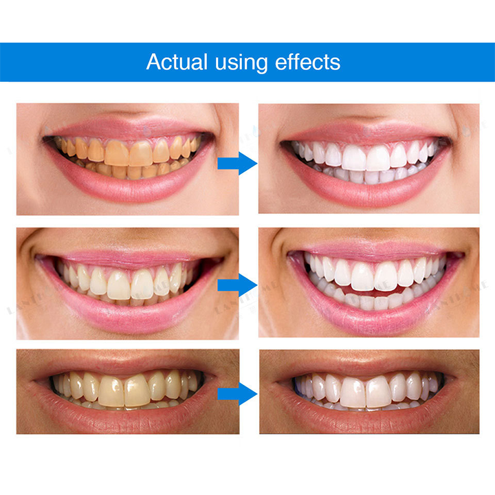 LIMETOW™ 🔥Teeth Whitening Essence🔥