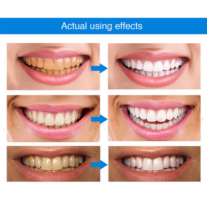 LIMETOW™ 🔥Teeth Whitening Essence🔥